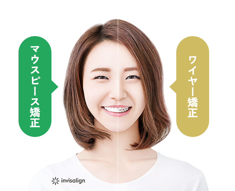 治療の比較