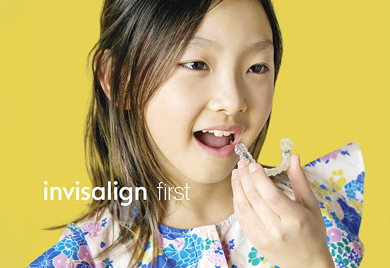 子どものマウスピース矯正